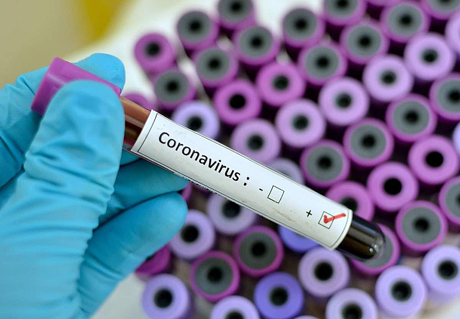 В Томской области зарегистрированы 56 новых случаев заболевания коронавирусом, 55 человек выздоровел