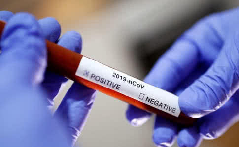 В Томской области зарегистрировано 56 новых случаев заболевания коронавирусом, 64 человека выздорове